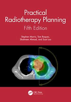 Practical Radiotherapy Planning