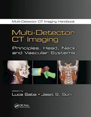 Multi-Detector CT Imaging