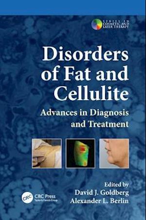 Disorders of Fat and Cellulite