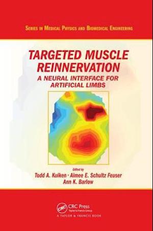 Targeted Muscle Reinnervation