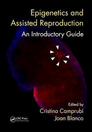 Epigenetics and Assisted Reproduction