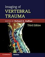 Imaging of Vertebral Trauma