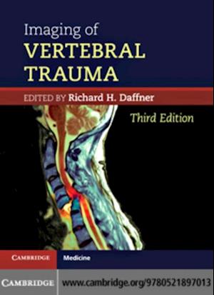 Imaging of Vertebral Trauma