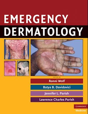 Emergency Dermatology