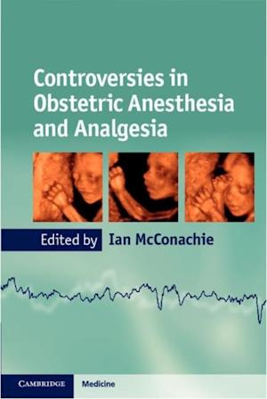 Controversies in Obstetric Anesthesia and Analgesia