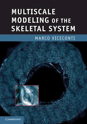 Multiscale Modeling of the Skeletal System