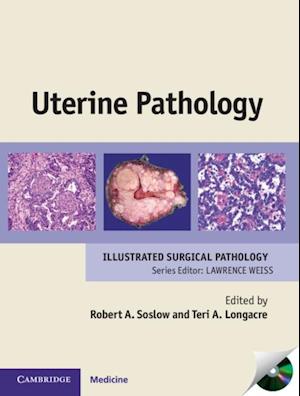 Uterine Pathology