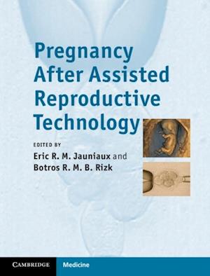 Pregnancy After Assisted Reproductive Technology