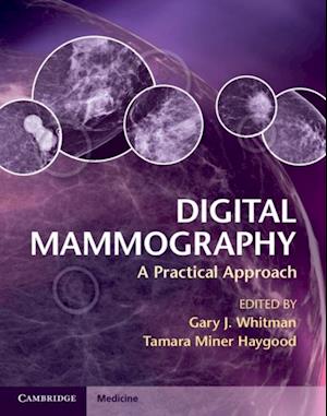 Digital Mammography