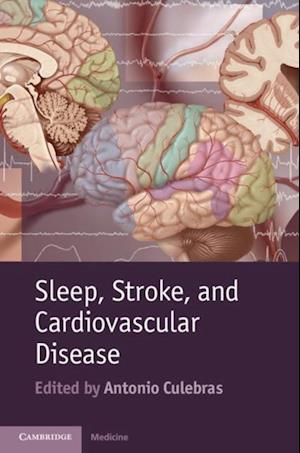 Sleep, Stroke and Cardiovascular Disease