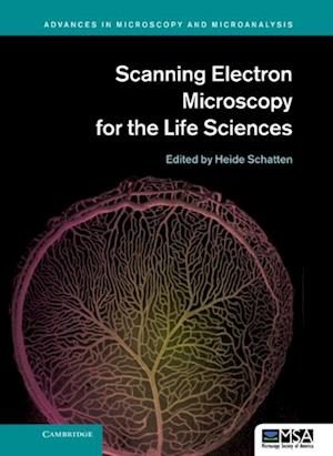 Scanning Electron Microscopy for the Life Sciences