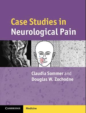Case Studies in Neurological Pain
