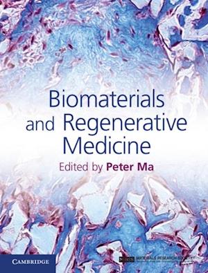 Biomaterials and Regenerative Medicine