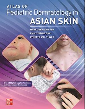 Atlas of Pediatric Dermatology in Asian Skin