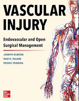 Vascular Injury