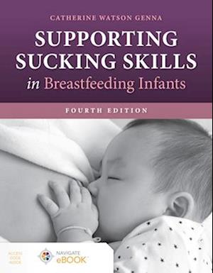 Supporting Sucking Skills in Breastfeeding Infants