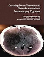 Cracking NeuroVascular and NeuroInterventional Neurosurgery Vignettes