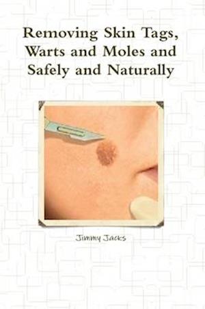 Removing Skin Tags, Warts and Moles and Safely and Naturally