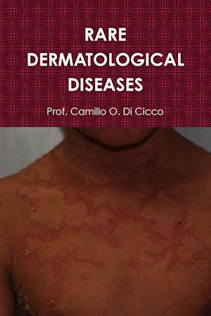 RARE DERMATOLOGICAL DISEASES