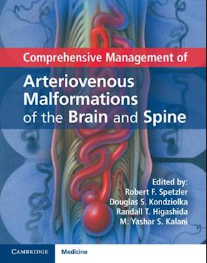 Comprehensive Management of Arteriovenous Malformations of the Brain and Spine