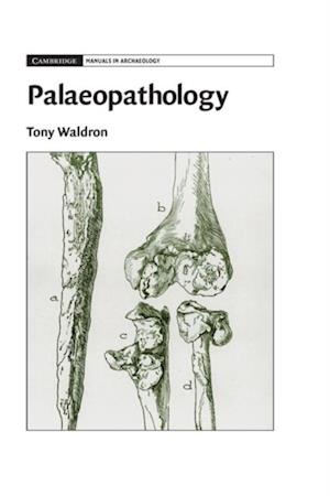 Palaeopathology