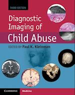 Diagnostic Imaging of Child Abuse