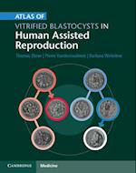 Atlas of Vitrified Blastocysts in Human Assisted Reproduction