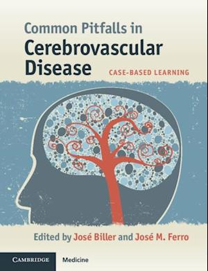 Common Pitfalls in Cerebrovascular Disease