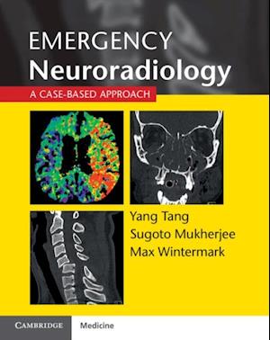 Emergency Neuroradiology