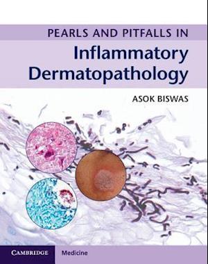 Pearls and Pitfalls in Inflammatory Dermatopathology