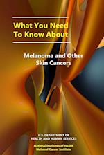 What You Need to Know About Melanoma and Other Skin Cancers