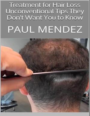 Treatment for Hair Loss: Unconventional Tips They Don't Want You to Know