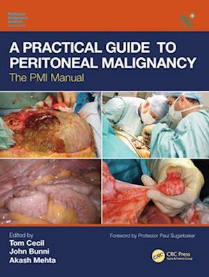 Practical Guide to Peritoneal Malignancy