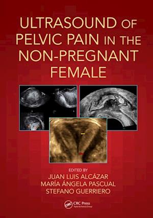 Ultrasound of Pelvic Pain in the Non-Pregnant Patient