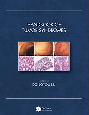 Handbook of Tumor Syndromes