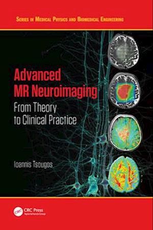 Advanced MR Neuroimaging