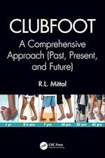 Clubfoot