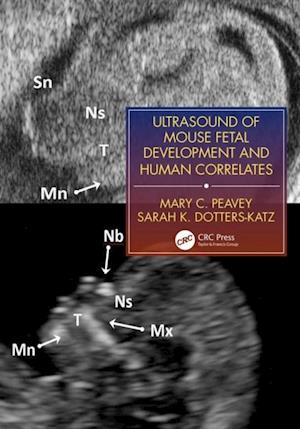 Ultrasound of Mouse Fetal Development and Human Correlates