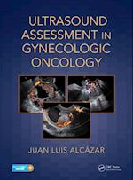 Ultrasound Assessment in Gynecologic Oncology