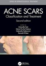 Acne Scars