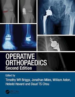 Operative Orthopaedics