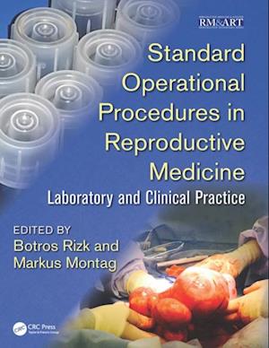 Standard Operational Procedures in Reproductive Medicine