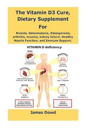 The Vitamin D3 Cure, Dietary supplement for Rickets, Osteomalacia, Osteoporosis, arthritis, eczema, kidney failure, Healthy Muscle Function, and Immun