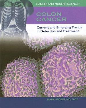 Colon Cancer