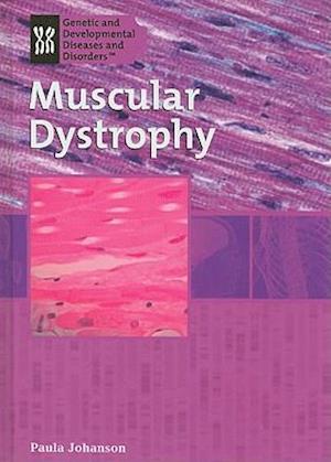 Muscular Dystrophy