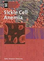 Sickle Cell Anemia