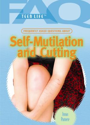Frequently Asked Questions about Self Mutilation and Cutting