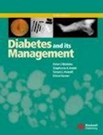 Diabetes and Its Management 6e