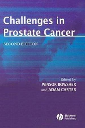 Challenges in Prostate Cancer 2e