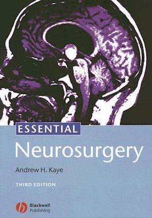 Essential Neurosurgery 3e